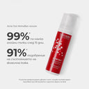 acne out: 3 стъпки срещу гнойни пъпки